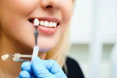 Crown Porcelain di RRDC Dental Care