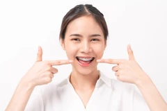 Pasang Behel Keramik di RRDC Dental Care