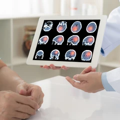 Paket Stroke Gold 6 Session di Physioku