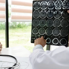 Paket Homeservice Stroke Silver 1 Session di Physioku