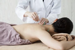 Dry Needling di Klinik Glowing Anti Aging & Wellness