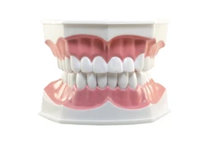 Bone Graft di Embun Galaxi Dental Care