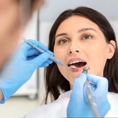 Tambal Gigi Glass Ionomer Cement di Praktik drg. Nina Miranti