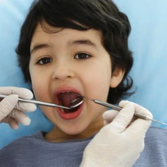 Cabut Gigi Susu dengan Injeksi di Praktik drg. Nina Miranti