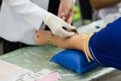 Medical Check Up Khusus Food Handler (6 Tes) di Laboratorium Klinik Galaxy