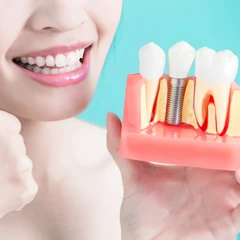 Perawatan Saluran Akar Gigi Belakang di Ruang Dental Clinic