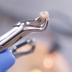 Cabut Gigi Dengan Mahkota di Ruang Dental Clinic