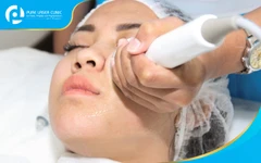 V-Shaped Face Contouring dengan Radio Frequency di Pure Laser Clinic