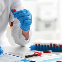 Pemeriksaan ACA-IgG di Amalia Medical Center