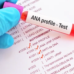 Pemeriksaan ANA PANEL TEST di Amalia Medical Center