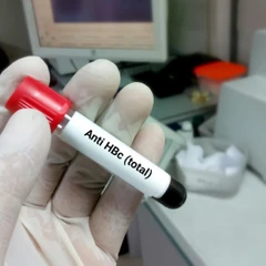 Pemeriksaan Hati (Anti HBc) di Amalia Medical Center