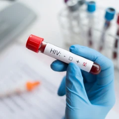 Pemeriksaan Anti HIV di Amalia Medical Center