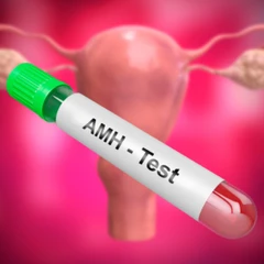 Pemeriksaan Anti Mulerien Hormon (AMH) di Amalia Medical Center