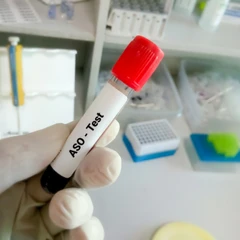 Pemeriksaan Jantung (ASO/ASTO) di Amalia Medical Center