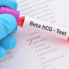 Pemeriksaan Hormon Kehamilan Beta HCG Kuantitatif Urine di Amalia Medical Center