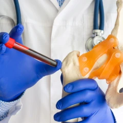 Pemeriksaan Calsium Ion di Amalia Medical Center