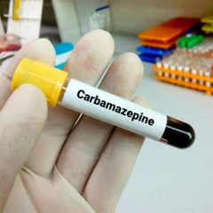 Pemeriksaan Carbamazepin di Amalia Medical Center