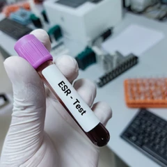 Pemeriksaan Erytrosit di Amalia Medical Center