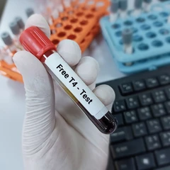 Pemeriksaan Free T4 di Amalia Medical Center