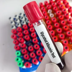 Pemeriksaan Diabetes (Glycated Albumin) di Amalia Medical Center