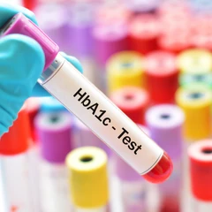 Pemeriksaan Diabetes (HbA1c) di Amalia Medical Center