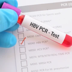 Pemeriksaan Hati (HBV DNA) di Amalia Medical Center