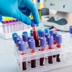 Pemeriksaan Hematologi Lengkap di Amalia Medical Center