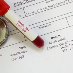 Pemeriksaan IgG CMV Avidity di Amalia Medical Center