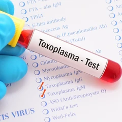 Pemeriksaan IgG Toxoplasma di Amalia Medical Center