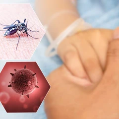 Pemeriksaan IgM Anti DHF di Amalia Medical Center