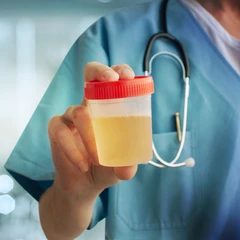 Pemeriksaan Kultur Urine untuk Skrining Infeksi Saluran Kemih di Amalia Medical Center