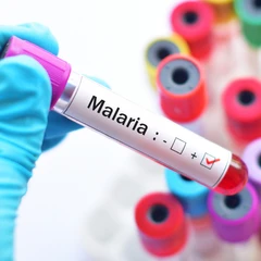 Pemeriksaan Malaria di Amalia Medical Center