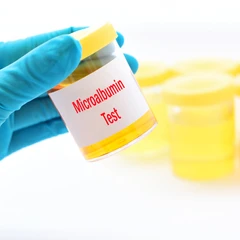 Pemeriksaan Mikroalbumin ( Urin 24 Jam ) di Amalia Medical Center