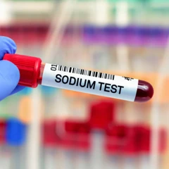 Pemeriksaan Natrium di Amalia Medical Center