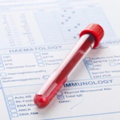Pemeriksaan Occult Blood Test di Amalia Medical Center