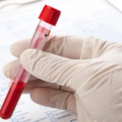 Pemeriksaan Opiate ( Screening Test ) di Amalia Medical Center