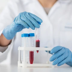 Pemeriksaan Pankreas (P-Amylase) di Amalia Medical Center