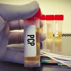 Pemeriksaan Phencyclidine (PCP) di Amalia Medical Center