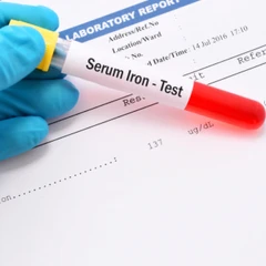 Pemeriksaan Serum Iron di Amalia Medical Center