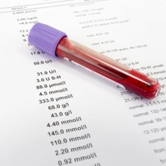 Pemeriksaan Paru-paru (Theophilin/Amynophilin) di Amalia Medical Center