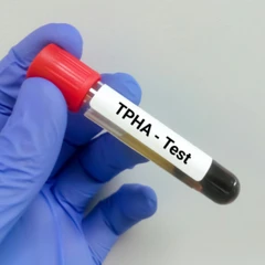 Pemeriksaan TPHA di Amalia Medical Center