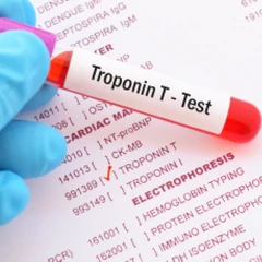 Pemeriksaan Troponin T di Amalia Medical Center