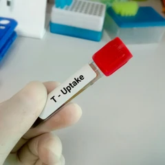 Pemeriksaan T-uptake di Amalia Medical Center