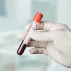 Pemeriksaan Ureum di Amalia Medical Center
