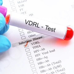 Pemeriksaan VDRL di Amalia Medical Center