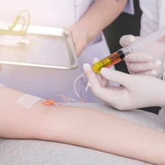 Suntik Vitamin C di Amalia Medical Center