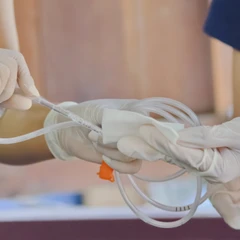 Pasang NGT Oleh Perawat di FastMed