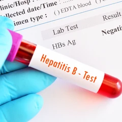 Pemeriksaan HBsAG (Hepatitis B) Titer di FastMed