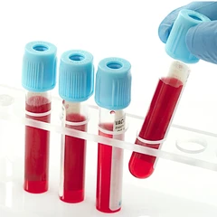 Pemeriksaan Kolesterol (HDL) di FastMed