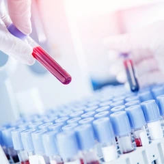 Pemeriksaan Hati (Anti HbS Titer) di FastMed